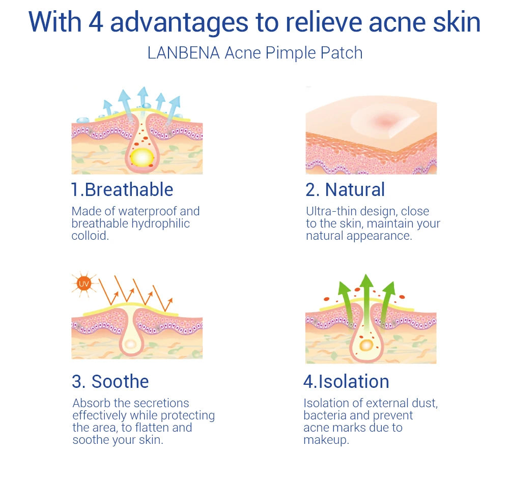 LANBENA Acne Pimple Patch